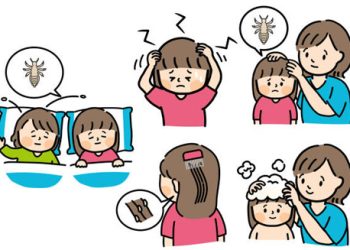 Illustration showing how head nits spread through contact, sharing beds, and hair inspection