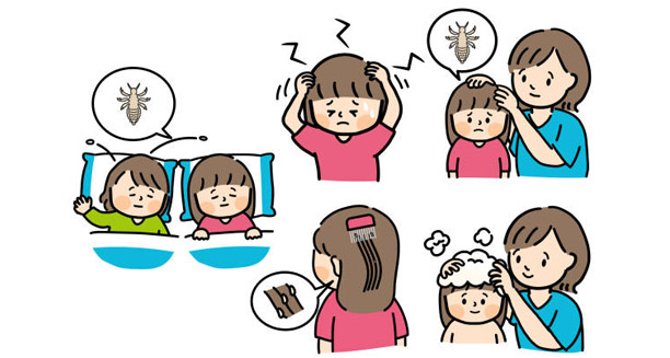 Illustration showing how head nits spread through contact, sharing beds, and hair inspection