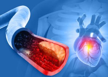 3D illustration showing blocked artery leading to heart with glowing damage zone