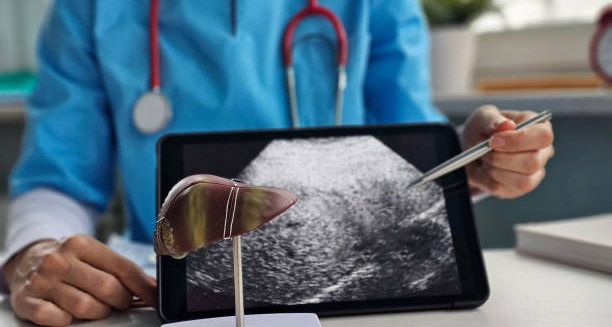 Doctor pointing at liver ultrasound scan to explain causes of hepatitis