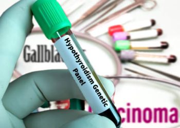 Blood test vial labelled for hypothyroidism genetic panel, indicating hereditary conditions