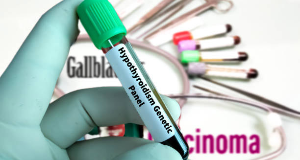 Blood test vial labelled for hypothyroidism genetic panel, indicating hereditary conditions
