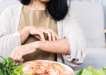 Woman scratching hives on her arm after eating shrimp