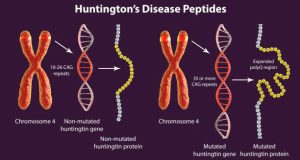 Causes of Huntington’s Disease