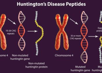 Causes of Huntington’s Disease
