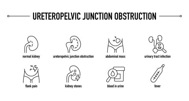 Infographic showing medical causes of hydronephrosis including kidney stones and infections