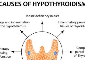 Diagram showing causes of hypothyroidism with thyroid illustration