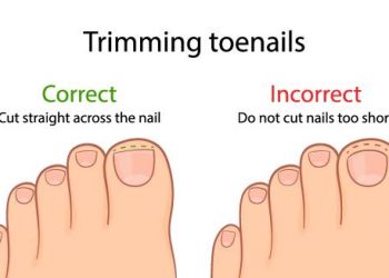 Causes of Ingrown Toenail