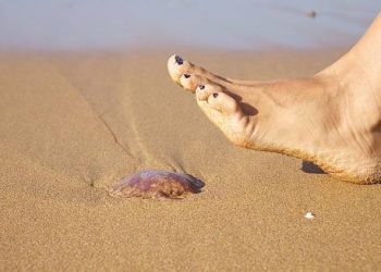 Barefoot person stepping near a jellyfish on the beach, illustrating the risk of jellyfish stings