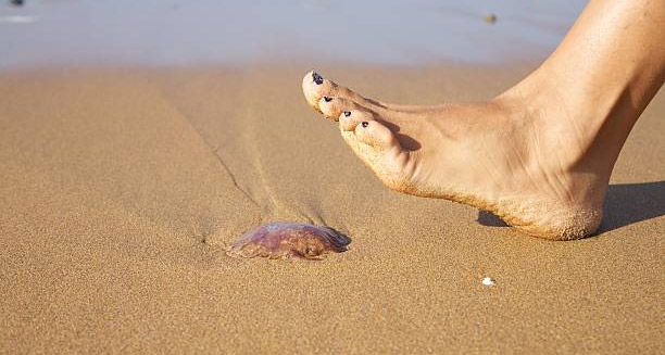 Barefoot person stepping near a jellyfish on the beach, illustrating the risk of jellyfish stings