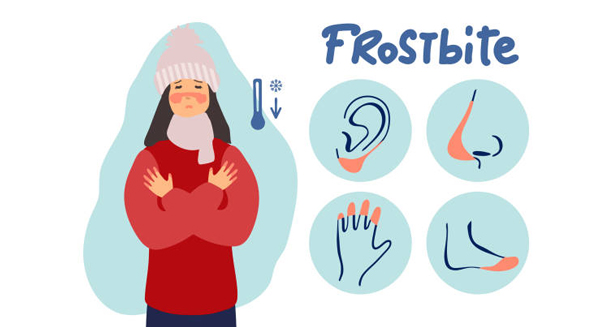Frostbite complications infographic with affected body parts