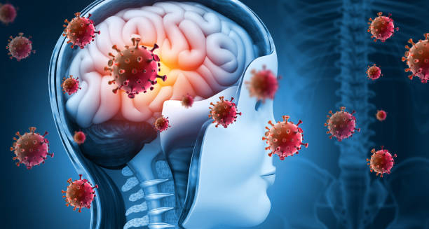 Medical illustration showing brain infection as a complication of Group B Strep