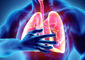 Respiratory complications of Guillain-Barré syndrome affecting the lungs