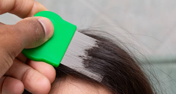 Close-up of lice comb being used to remove head lice from a child’s hair