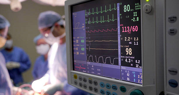 Cardiac monitor displaying vital signs during heart surgery, indicating severe heart complications