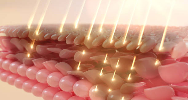 Close-up 3D skin layers with heat rays penetrating the surface, illustrating complications of heat rash