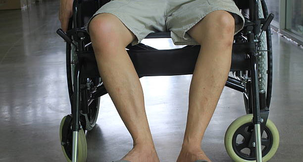 Man in a wheelchair showing lower limb weakness due to hereditary spastic paraplegia complications