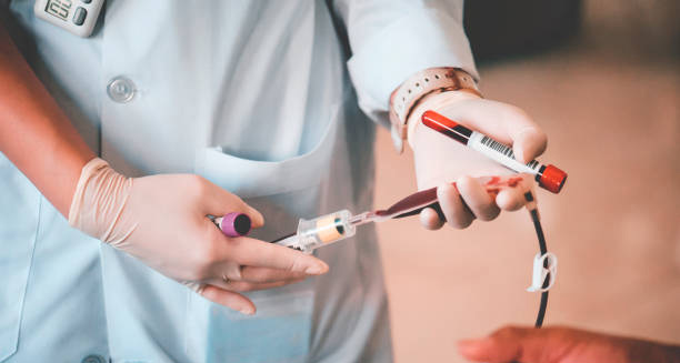 Medical professional holding blood vials and transfusion equipment for anaemia-related treatment