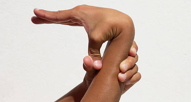 Hand demonstrating extreme flexibility, indicating joint hypermobility syndrome complications