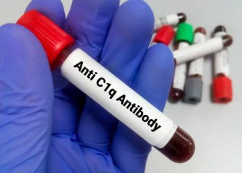 Blood test sample labelled Anti C1q Antibody held by gloved hand