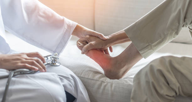 Doctor examining inflamed foot for gout diagnosis