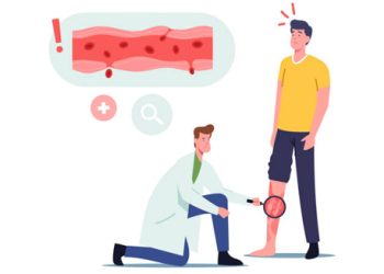Doctor examining leg rash to diagnose granulomatosis with polyangiitis