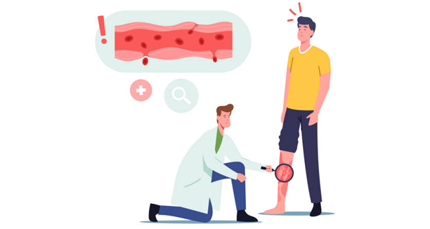 Doctor examining leg rash to diagnose granulomatosis with polyangiitis
