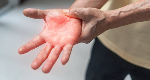Elderly person experiencing numbness in the hand, a symptom used in Guillain-Barré syndrome diagnosis