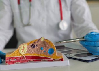 Doctor pointing at anatomical model of male breast tissue