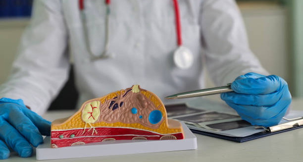 Doctor pointing at anatomical model of male breast tissue