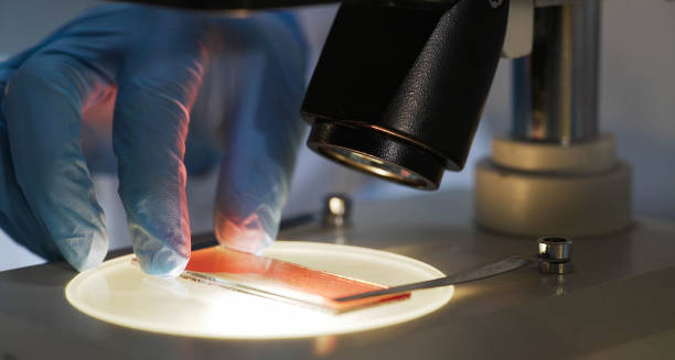 Microscope slide being prepared for blood analysis