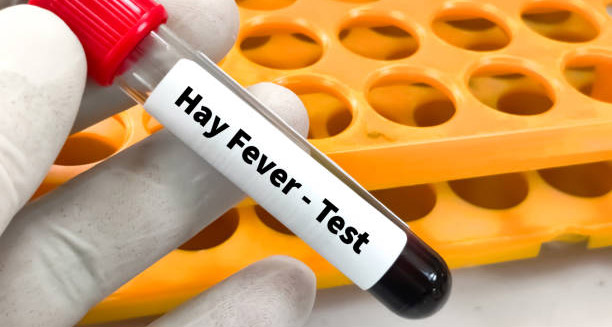 Gloved hand holding a blood sample tube labelled “Hay Fever – Test” beside a test rack