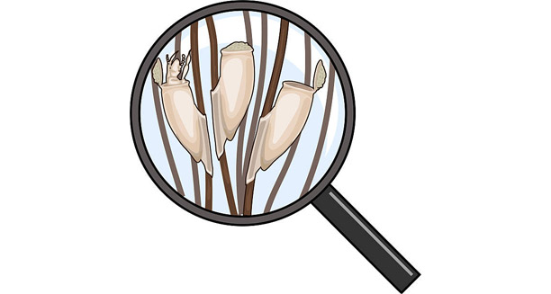 Diagnosis of Head Lice