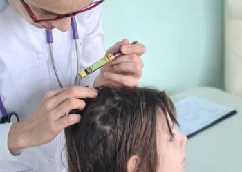 Doctor examining a young child’s scalp for head lice using a magnifying glass