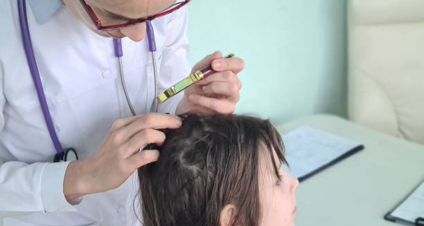 Doctor examining a young child’s scalp for head lice using a magnifying glass