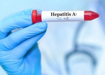 Positive hepatitis A test result in gloved hand of healthcare professional