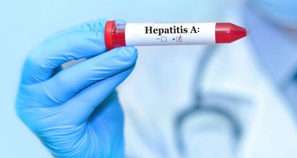 Positive hepatitis A test result in gloved hand of healthcare professional