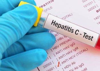Hepatitis C blood test sample held by gloved hand over lab results