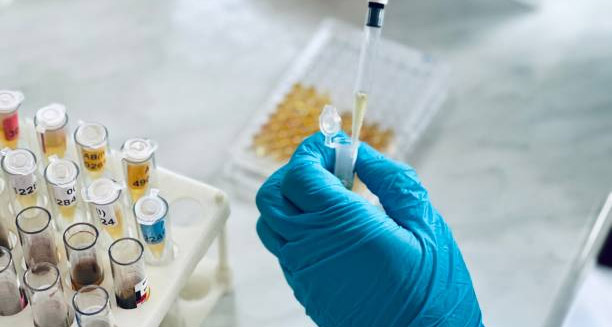 Gloved hand handling blood samples during hepatitis diagnosis