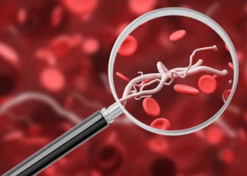 Magnified view of abnormal blood vessels among red blood cells, symbolising vascular irregularities