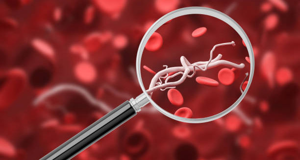 Magnified view of abnormal blood vessels among red blood cells, symbolising vascular irregularities