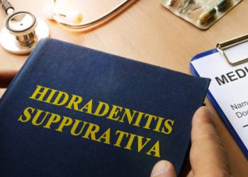 Medical book titled Hidradenitis Suppurativa next to a clipboard with patient health records and a stethoscope