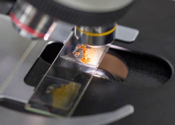 Microscope examining a stool sample for hookworm diagnosis