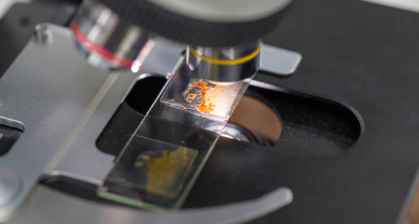 Microscope examining a stool sample for hookworm diagnosis