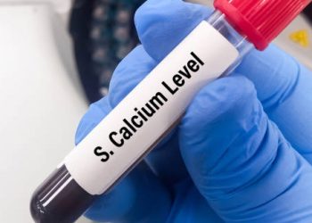 Blood sample tube labelled S. Calcium Level held by gloved hand for hyperparathyroidism diagnosis