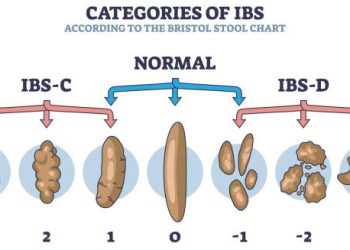 Bristol stool chart showing IBS-C, IBS-D, and normal stool types for IBS diagnosis