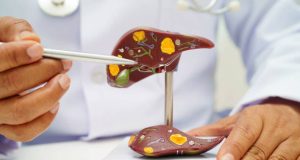 Doctor pointing at a liver model to explain the diagnosis of jaundice and bile flow issues