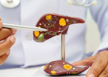 Doctor pointing at a liver model to explain the diagnosis of jaundice and bile flow issues