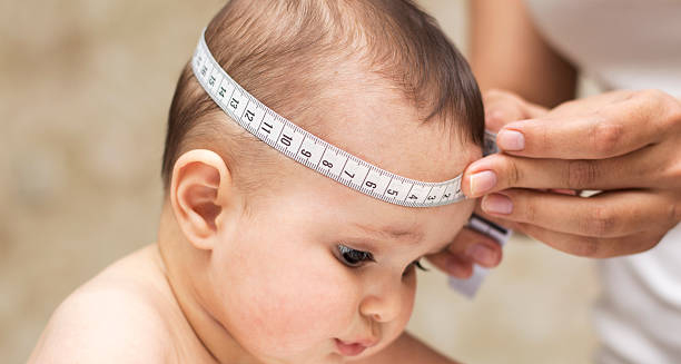 Measuring infant’s head for flat head syndrome