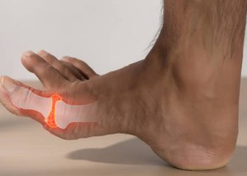 Inflamed toe joint with highlighted gout pain